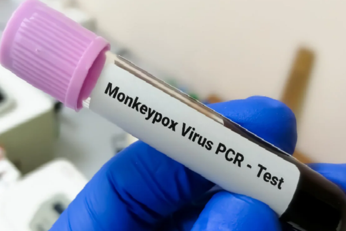 En Santa Cruz confirman dos casos de viruela símica y cuatro sospechosos y el Sedes intensifica vigilancia epidemiológica